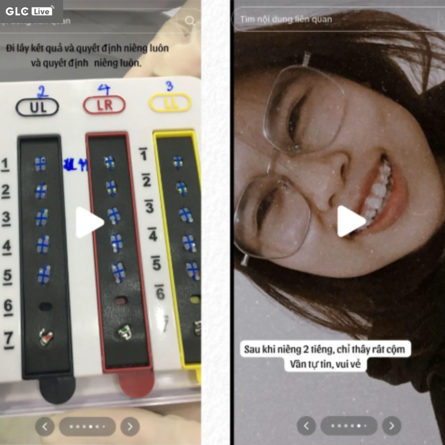 Vị trí đặt text bị lộn xộn giữa các ảnh